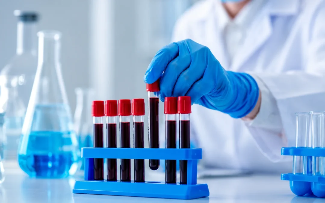 How Routine Blood Tests Can Help Detect Health Problems Early