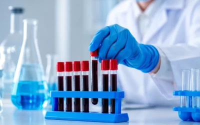 How Routine Blood Tests Can Help Detect Health Problems Early